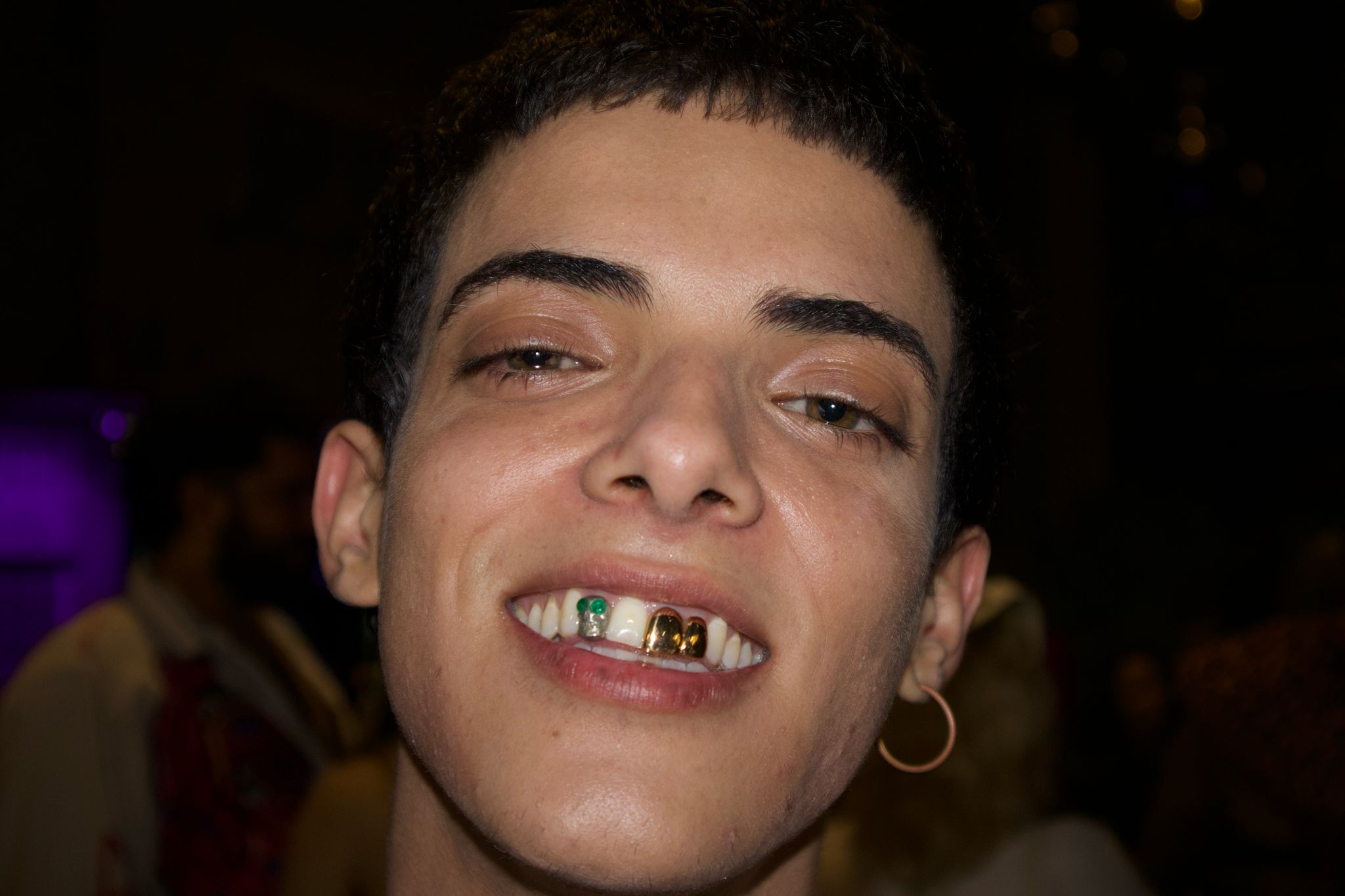 dents